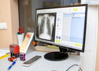 FN Ostrava se zapojila do pilotního screeningového programu časného záchytu karcinomu plic